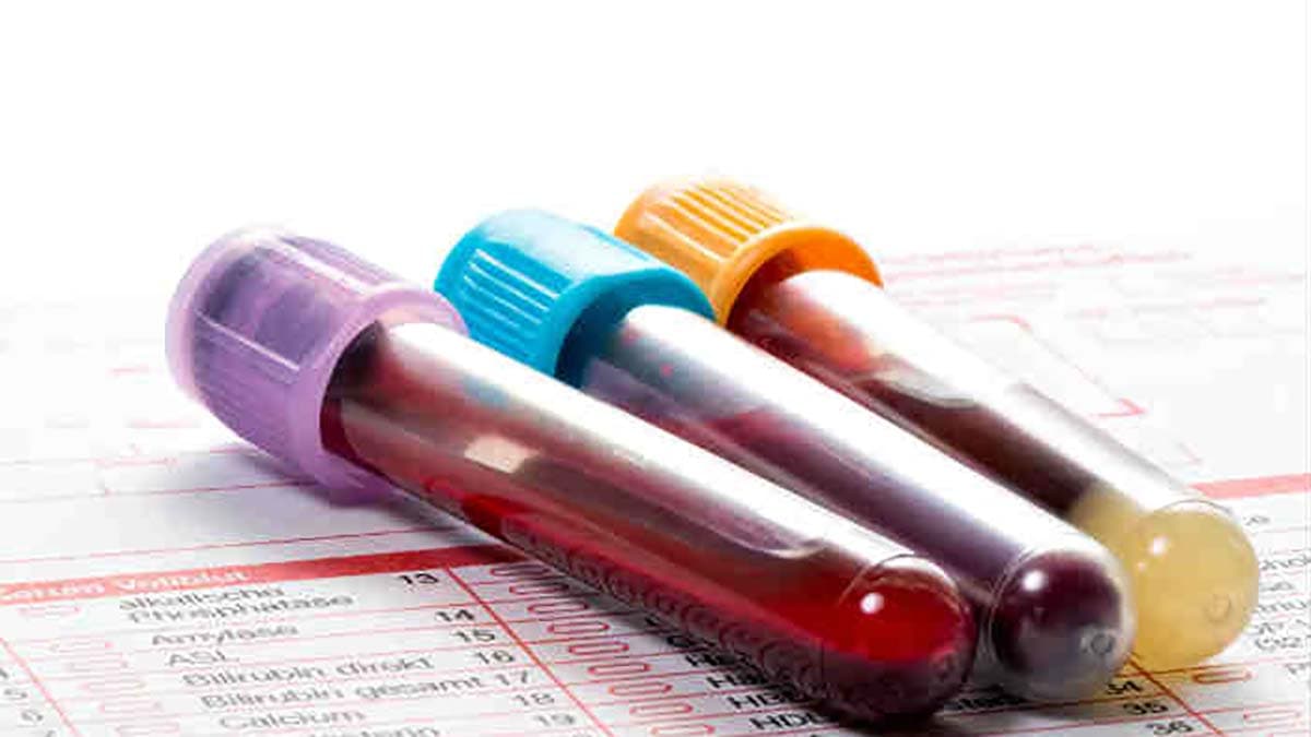 Studio Unical: un valore del sangue ci dice qual è il rischio individuale di morte. Ecco quale