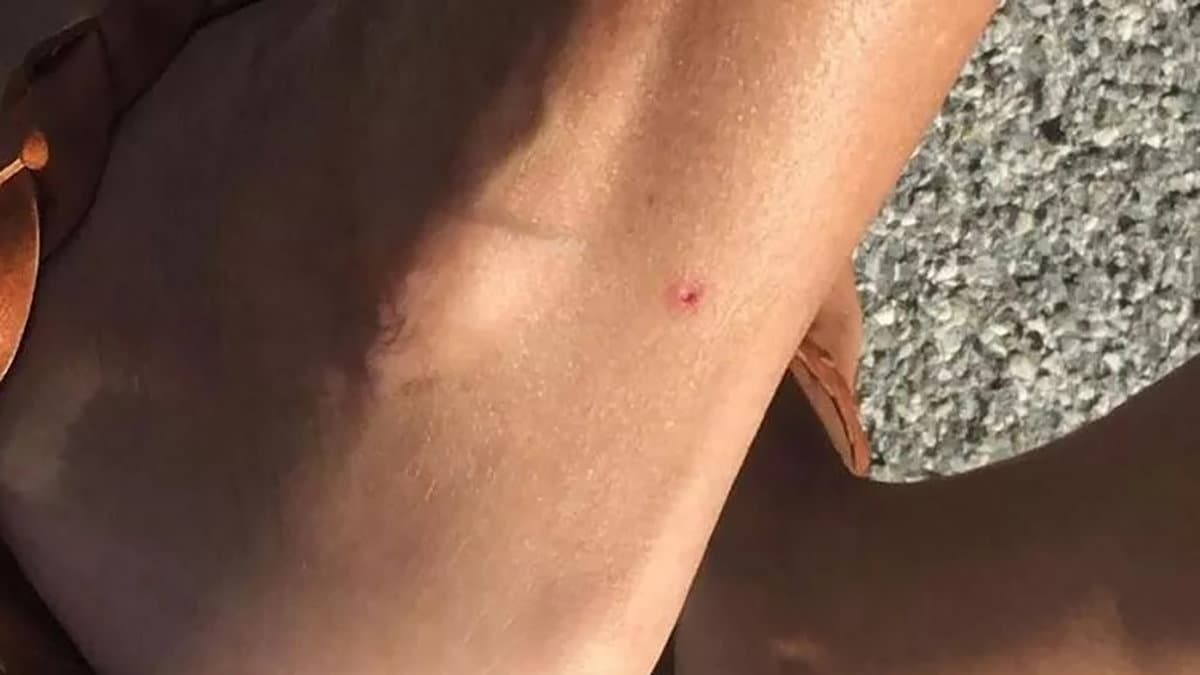 I pesci che mordono in riva al mare nella Sibaritide, piccoli ma terribili!