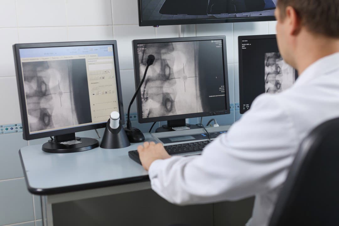 Tele-radiologia, a Cassano c'è ma non funziona: «Ci chiediamo perché?»