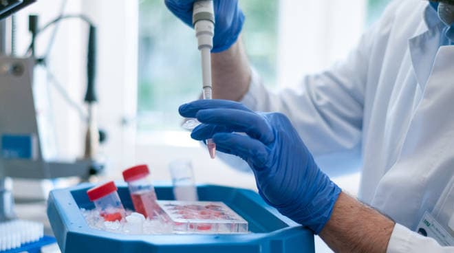 Coronavirus, due persone in isolamento volontario a Francavilla Marittima