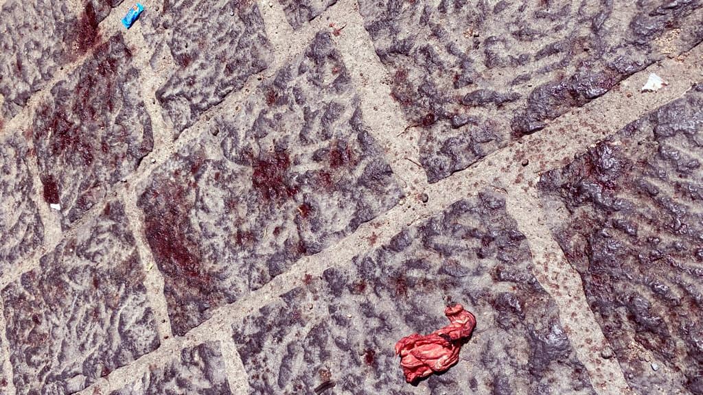 Dal degrado affiorano anche "chiazze di sangue". Sembra un film di Kubrick... ma non lo è