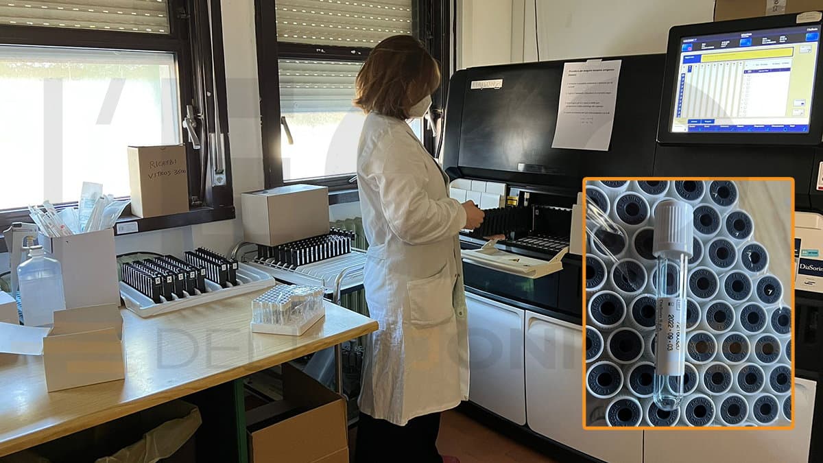 Rapidi, attendibili e resistenti: al "Giannettasio" arrivano i tamponi covid chemiluminescenti