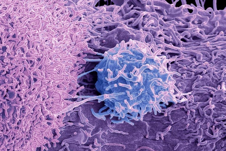 Campagna di prevenzione del tumore alla prostata. Primo appuntamento a Cosenza